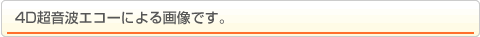 4D超音波エコー